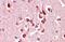 Unc-5 Netrin Receptor C antibody, GTX47544, GeneTex, Immunohistochemistry paraffin image 
