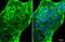 Angiotensin I Converting Enzyme 2 antibody, GTX101395, GeneTex, Immunofluorescence image 