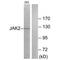 Janus Kinase 2 antibody, A00027, Boster Biological Technology, Western Blot image 