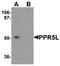 Proline Rich 5 Like antibody, orb75604, Biorbyt, Western Blot image 