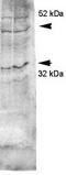 Aquaporin-4 antibody, TA326513, Origene, Western Blot image 