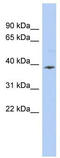 Apolipoprotein L6 antibody, TA341406, Origene, Western Blot image 