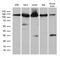 Importin 5 antibody, M05073, Boster Biological Technology, Western Blot image 