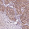 Translocase Of Outer Mitochondrial Membrane 70 antibody, HPA048020, Atlas Antibodies, Immunohistochemistry frozen image 