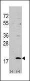 Hippocalcin-like protein 1 antibody, LS-C97750, Lifespan Biosciences, Western Blot image 