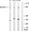 Signal Transducer And Activator Of Transcription 1 antibody, LS-B11151, Lifespan Biosciences, Western Blot image 