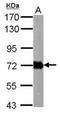 Helicobacter pylori urease B antibody, NBP2-42851, Novus Biologicals, Western Blot image 