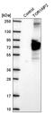 Torsin 1A Interacting Protein 2 antibody, HPA051849, Atlas Antibodies, Western Blot image 