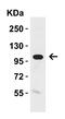 Klotho antibody, A02616, Boster Biological Technology, Western Blot image 