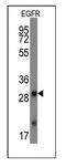 EGFR antibody, AM11067SU-N, Origene, Western Blot image 