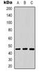 DnaJ Heat Shock Protein Family (Hsp40) Member A1 antibody, orb339094, Biorbyt, Western Blot image 