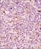 BCL2 Like 11 antibody, NBP2-53088, Novus Biologicals, Immunohistochemistry paraffin image 