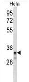 Low Density Lipoprotein Receptor Class A Domain Containing 2 antibody, LS-C165736, Lifespan Biosciences, Western Blot image 