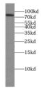 Chondroitin Polymerizing Factor antibody, FNab01671, FineTest, Western Blot image 