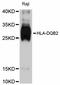 Major Histocompatibility Complex, Class II, DQ Beta 2 antibody, abx125946, Abbexa, Western Blot image 