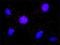 BUB1 Mitotic Checkpoint Serine/Threonine Kinase antibody, H00000699-D01P, Novus Biologicals, Proximity Ligation Assay image 