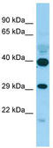 Phosphatidylserine Decarboxylase antibody, TA338092, Origene, Western Blot image 