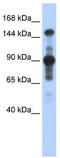 Misshapen Like Kinase 1 antibody, TA331130, Origene, Western Blot image 
