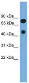 Receptor Interacting Serine/Threonine Kinase 4 antibody, TA338942, Origene, Western Blot image 