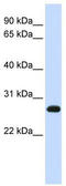 Synaptosome Associated Protein 23 antibody, TA346718, Origene, Western Blot image 