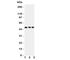 Annexin A7 antibody, R31187, NSJ Bioreagents, Western Blot image 