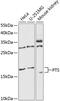 6-Pyruvoyltetrahydropterin Synthase antibody, 15-347, ProSci, Western Blot image 