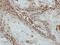 Spermatogenesis And Oogenesis Specific Basic Helix-Loop-Helix 2 antibody, PA5-30658, Invitrogen Antibodies, Immunohistochemistry frozen image 