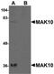 N(Alpha)-Acetyltransferase 35, NatC Auxiliary Subunit antibody, PA5-20783, Invitrogen Antibodies, Western Blot image 