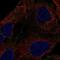 DENN Domain Containing 3 antibody, PA5-64996, Invitrogen Antibodies, Immunofluorescence image 