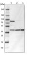 Isocitrate dehydrogenase [NAD] subunit gamma, mitochondrial antibody, PA5-51668, Invitrogen Antibodies, Western Blot image 