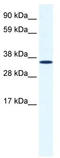 Annexin A2 antibody, TA341656, Origene, Western Blot image 