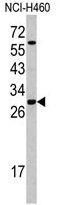 Serine And Arginine Rich Splicing Factor 5 antibody, GTX81806, GeneTex, Western Blot image 