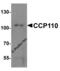 Centrosomal protein CP110 antibody, 6825, ProSci, Western Blot image 