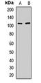 Kinesin Family Member 5A antibody, LS-C668577, Lifespan Biosciences, Western Blot image 