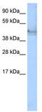 Keratin 14 antibody, TA330018, Origene, Western Blot image 