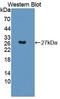Synaptosome Associated Protein 23 antibody, LS-C702965, Lifespan Biosciences, Western Blot image 