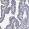 5-azacytidine-induced protein 1 antibody, NBP1-90053, Novus Biologicals, Immunohistochemistry frozen image 