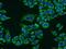 ATP Synthase F1 Subunit Beta antibody, 17247-1-AP, Proteintech Group, Immunofluorescence image 