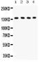 Phospholipase C Beta 1 antibody, PB9346, Boster Biological Technology, Western Blot image 