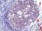 Protein Tyrosine Kinase 2 antibody, ab40794, Abcam, Immunohistochemistry paraffin image 
