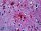 GFAP antibody, LS-B5176, Lifespan Biosciences, Immunohistochemistry paraffin image 