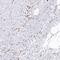 SH3 And PX Domains 2B antibody, HPA036471, Atlas Antibodies, Immunohistochemistry frozen image 