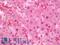 T Cell Leukemia Homeobox 2 antibody, LS-B10110, Lifespan Biosciences, Immunohistochemistry frozen image 