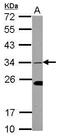 ETS Homologous Factor antibody, PA5-30716, Invitrogen Antibodies, Western Blot image 