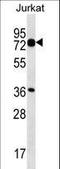Plastin 1 antibody, LS-C163799, Lifespan Biosciences, Western Blot image 