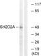 Ribp antibody, GTX87514, GeneTex, Western Blot image 