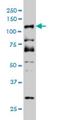 Cyclin D Binding Myb Like Transcription Factor 1 antibody, H00009988-M03, Novus Biologicals, Western Blot image 