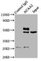 3-ketoacyl-CoA thiolase, mitochondrial antibody, LS-C669611, Lifespan Biosciences, Immunoprecipitation image 