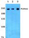Plexin A2 antibody, PA5-37199, Invitrogen Antibodies, Western Blot image 