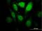 Homeodomain-interacting protein kinase 1 antibody, H00204851-M04, Novus Biologicals, Immunocytochemistry image 